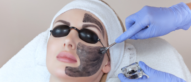 carbon laser peel 